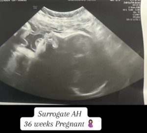 Babytree Surrogacy shares an ultrasound at 36 weeks, showing a healthy baby and confirming the surrogate’s advanced pregnancy. babytree